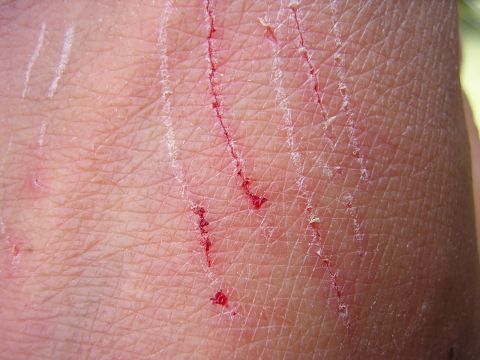 scratch.jpg