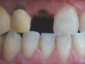 teeth.jpg